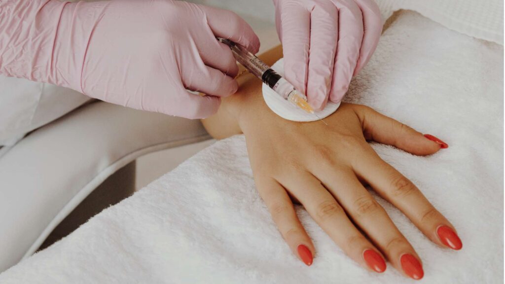 hand rejuvenation treatment