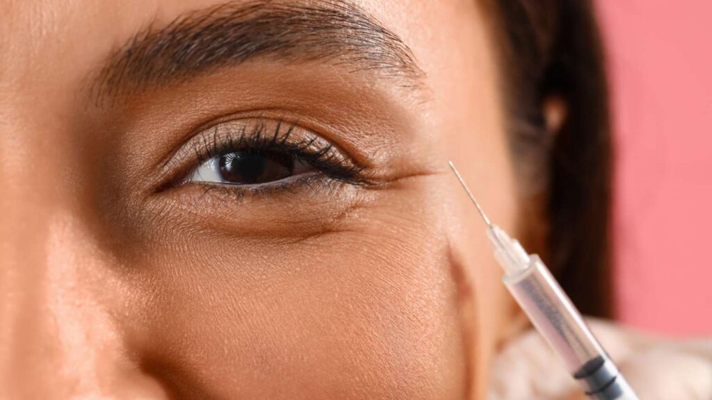 under eye filler