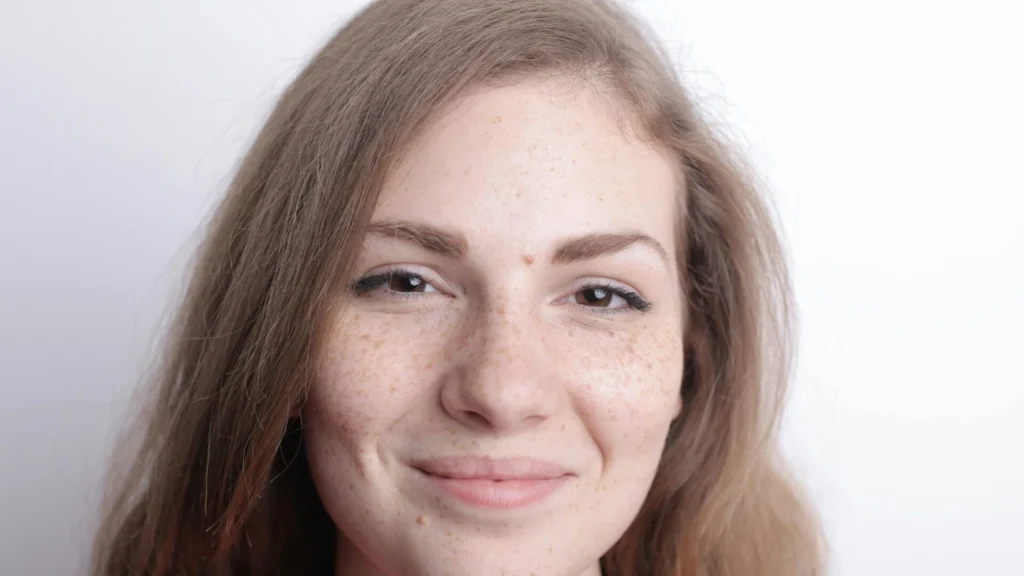 Dark Spots