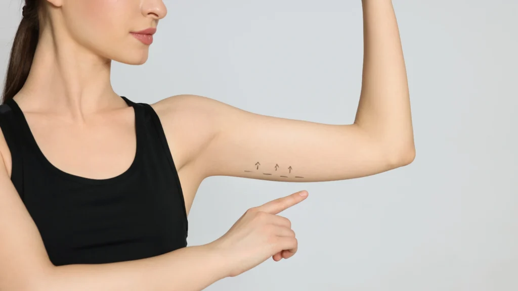 arm liposuction in Dubai
