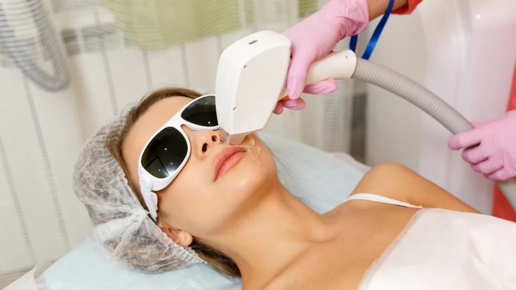 laser hair removal aftercare