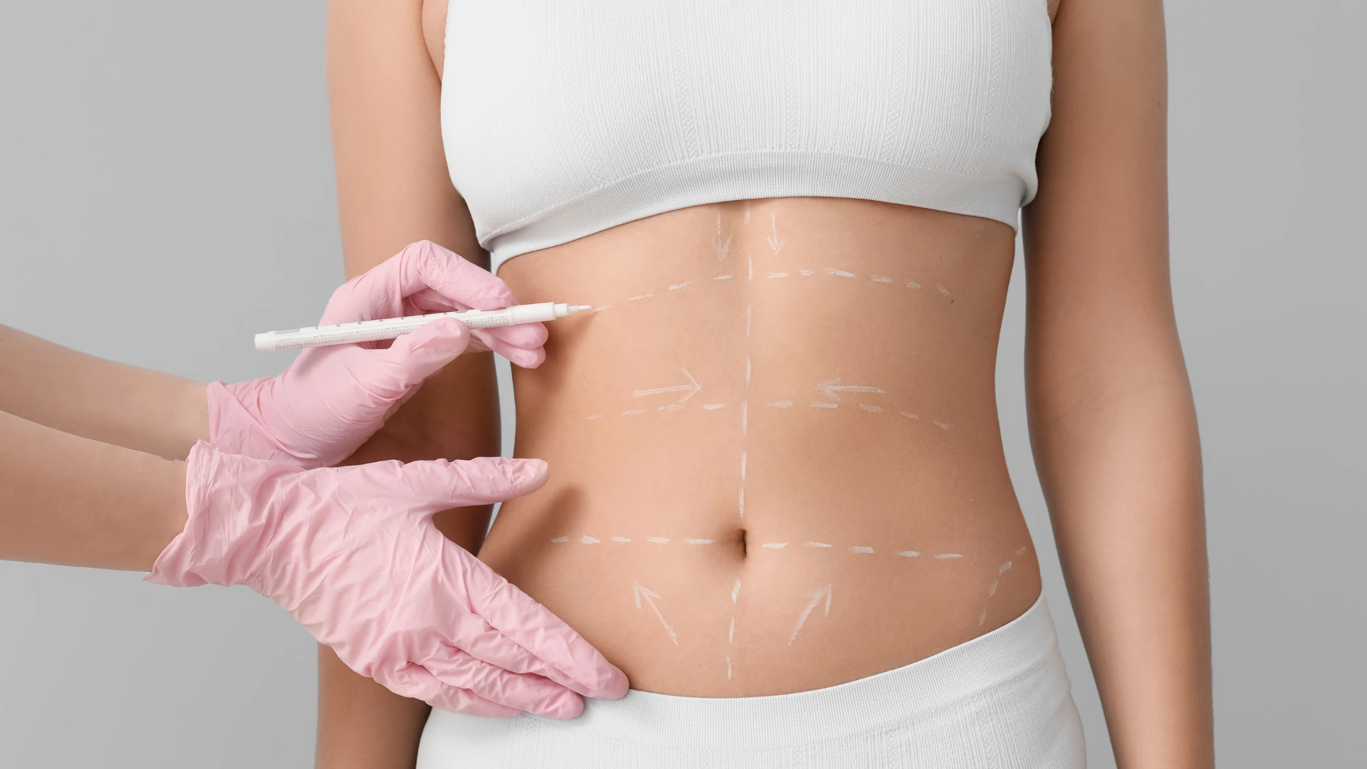 liposuction and abdominoplasty