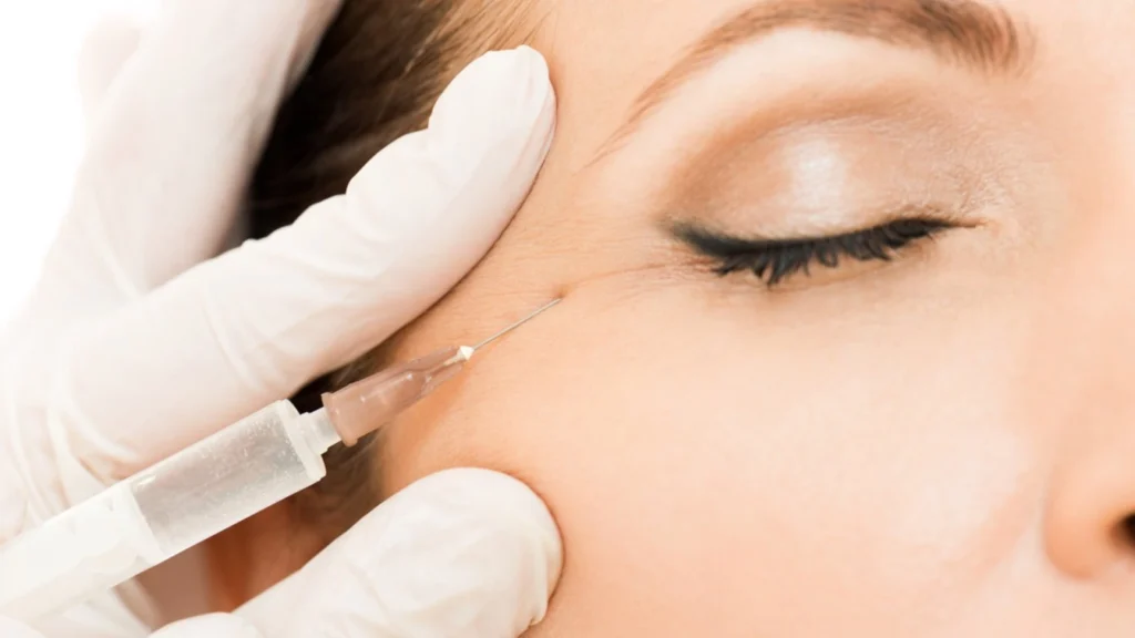uneven under eye filler