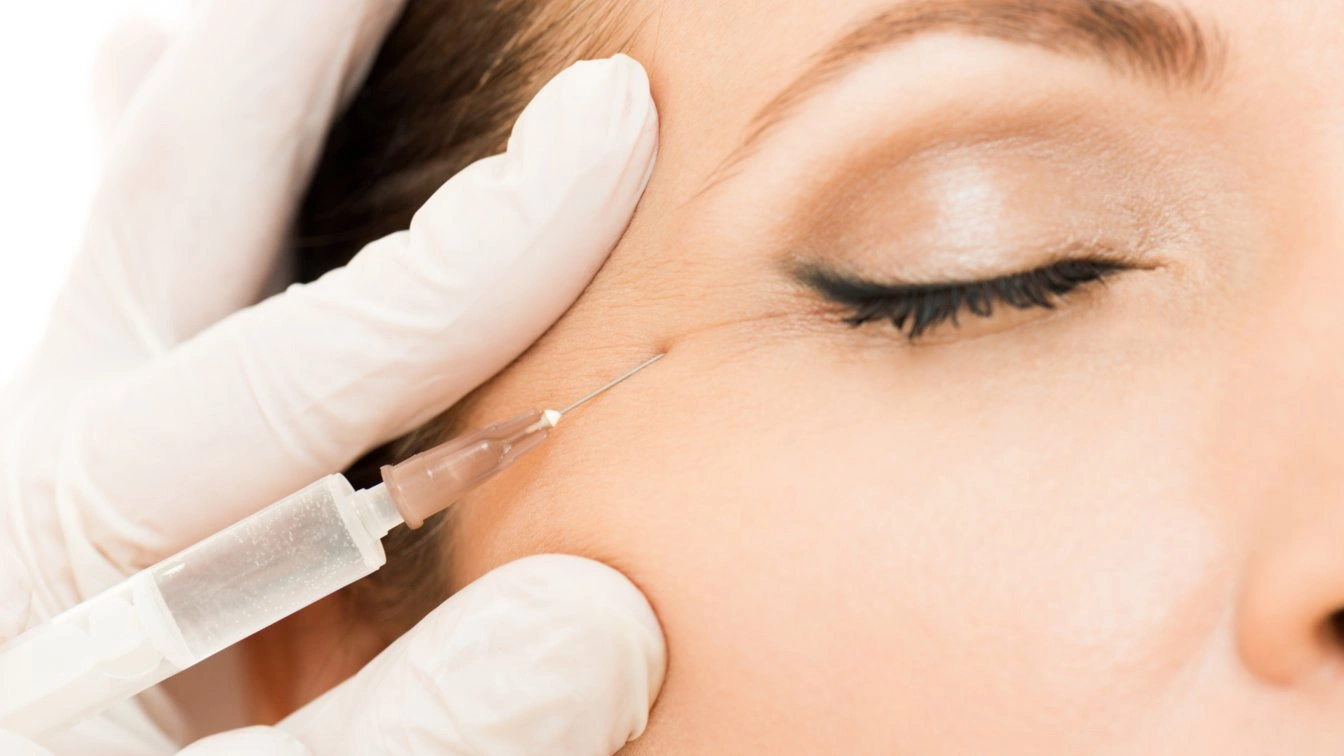 uneven under eye filler