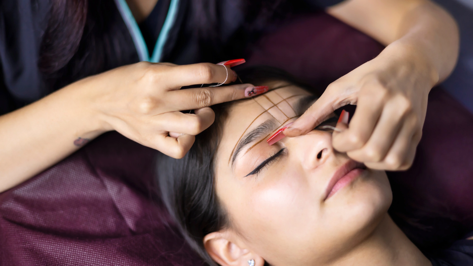 endoscopic eyebrow lift