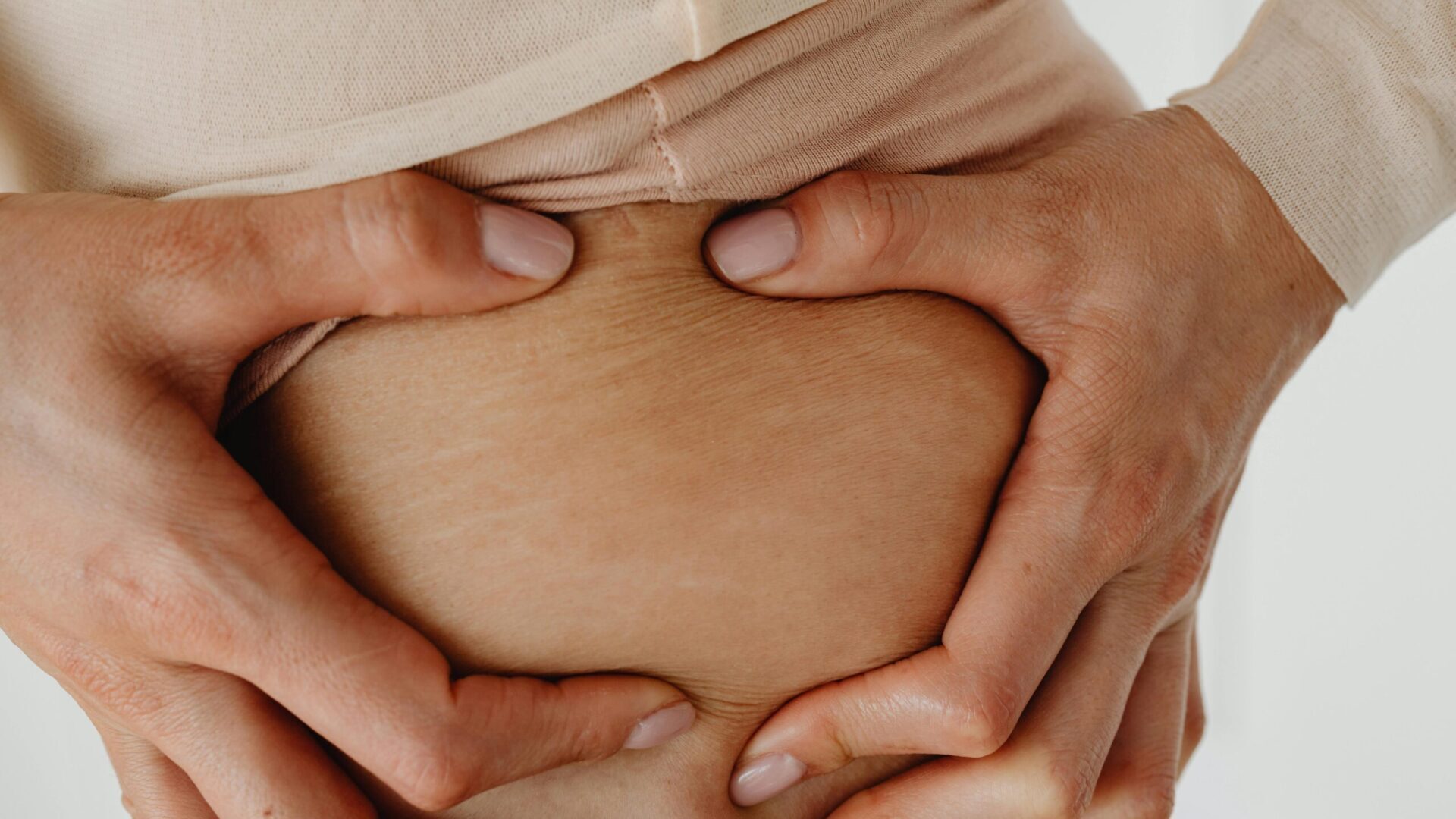 Stretch Marks